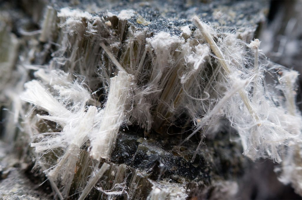 Asbestosis